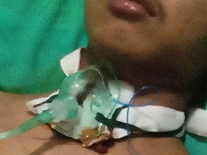 Leher Warga Jembrana Luka Serius Terjerat Kabel WiFi