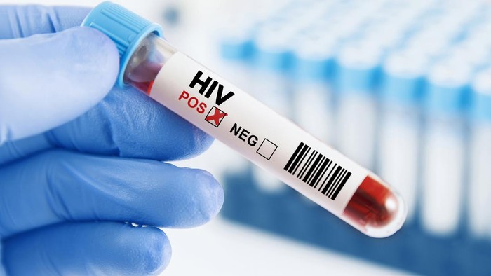 Human immunodeficiency virus blood test in hand
