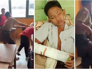 Perundungan Siswa SMP di Lampung Akibatkan Korban Patah Tangan