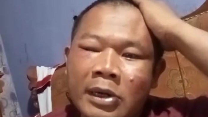 Cucu Yusuf (42) warga Bojonggambir, Kabupaten Tasikmalaya yang dihakimi massa usai disangka begal