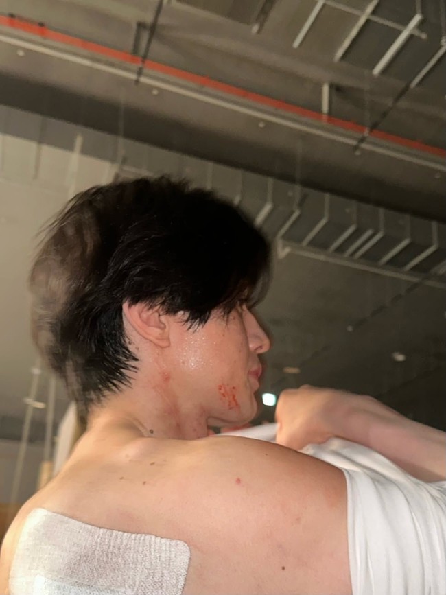 Lee Dong Wook memperlihatkan tubuh atletisnya yang tampak dihiasi luka sisa-sisa syuting A Shop for Killers 2. Drama Korea yang tayang di Disney+ ini memang banyak menampilkan aksi laga para pemainnya. Foto: Dok. Instagram Lee Dong Wook