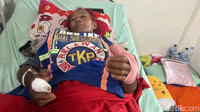 Zaenal relawan Mojokerto digigit ular kobra dan tangannya dioperasi