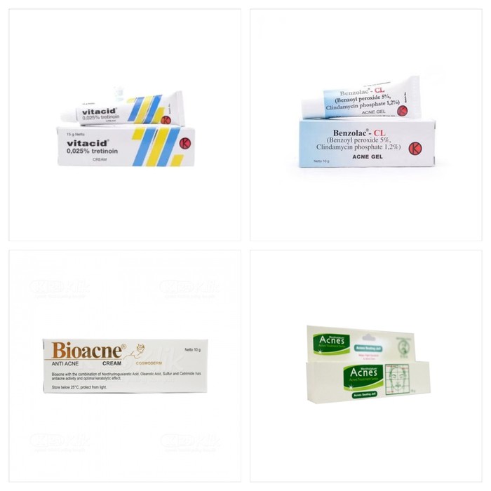 Obat Jerawat Ampuh di Apotek