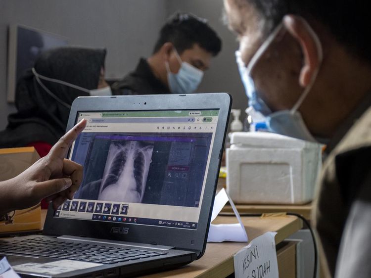 Skrining TB dan Cek Kesehatan Gratis Digelar bagi Warga Kawasan Karst