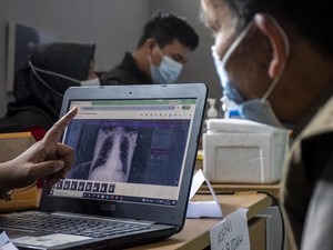 Punya Inovator Teknologi Kesehatan di Daerah? Daftarkan ke DPD RI Awards