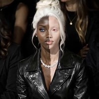 Model dengan Kulit 2 Warna Viral, Ternyata Bukan Manusia Asli