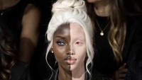 Model dengan Kulit 2 Warna Viral, Ternyata Bukan Manusia Asli