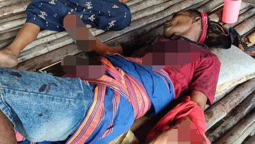 Seorang guru bernama Didimus Mone Dadi mengalami luka parah di bagian dada dan tangan kirinya setelah dibacok di Desa Karuni, Kecamatan Kota Tambolaka, Kabupaten Sumba Barat Daya, NTT, Kamis (30/7/2026). (Dok. Polres Sumba Barat Daya).