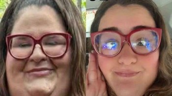 Kacamata merahnya masih sama, tetapi bentuk wajahnya berubah drastis. Beginilah ketika filter kecantikan digunakan kelewat batas. Foto: Boredpanda