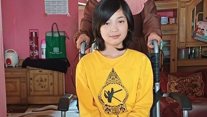 Sahabat Baik, Mari Bantu Osi Punya Kaki Palsu agar Bisa Lanjut Sekolah (Dok Berbuat Baik).