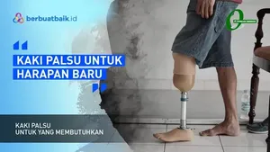 Kaki Palsu untuk Osi Agar Bisa Beraktivitas di Sekolah