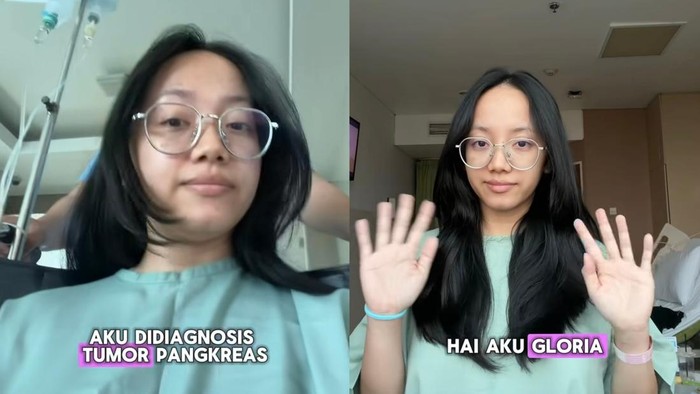 Viral wanita kena tumor pankreas.