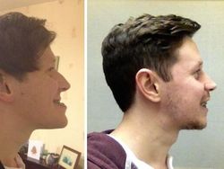 Bikin Melongo! Foto Before-After Ini Tunjukkan Perubahan Ekstrem