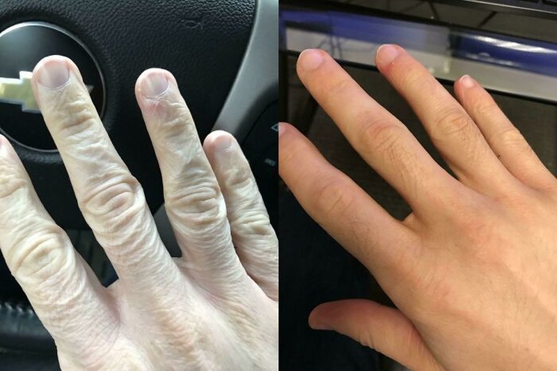 Foto Before-After Ini Tunjukkan Perubahan Ekstrem