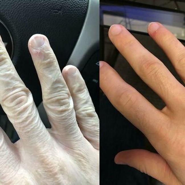 Bikin Melongo! Foto Before-After Ini Tunjukkan Perubahan Ekstrem