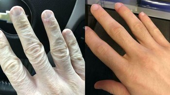 Sebelum menggunakan lotion. Foto: via Boredpanda
