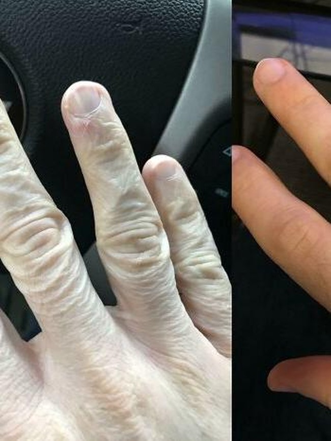 Bikin Melongo! Foto Before-After Ini Tunjukkan Perubahan Ekstrem