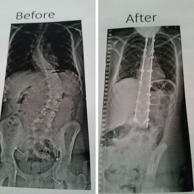 Foto Before-After Ini Tunjukkan Perubahan Ekstrem
