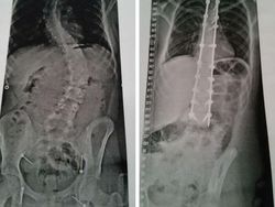 Bikin Melongo! Foto Before-After Ini Tunjukkan Perubahan Ekstrem
