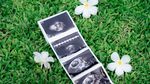 Irish Bella Bahagia Banget Penantian Panjang Hamil Anak Haldy Sabri Terkabul