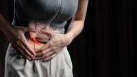 Radang Usus Buntu Viral gara-gara Selebgram Berobat ke Penang, Dokter Beberkan Gejalanya