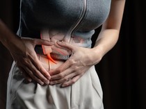 Wamenkes Sebut Berobat Usus Buntu Nggak Perlu ke LN, Dokter RI Lebih Pengalaman