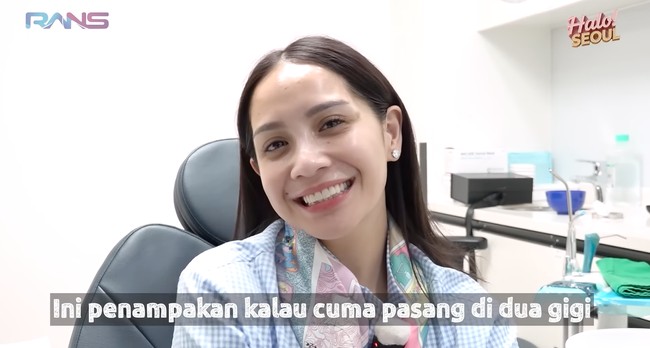 Tampak bagian depan 2 gigi Nagita yang sudah terpasang veneer. Nagita sendiri memang sengaja meminta warna veneer yang tidak terlalu putih agar tetap terlihat natural. Foto: YouTube/Rans Entertainment