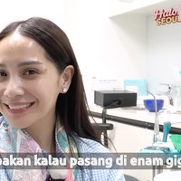 Hasil setelah pemasangan veneer selesai. Nagita diketahui memasang 6 veneer pada bagian gigi atasnya. Di awal pemasangan ia mengaku masih merasa aneh dan merasa seperti ada yang mengganjal. Foto: YouTube/Rans Entertainment