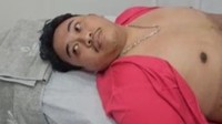 Bos Narkoba Kampung Bahari Ditangkap Saat Sedot Lemak di Klinik Kecantikan