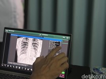 Ratusan Santri di Jakut Jalani Skrining TB Lewat CKG, Ada Temuan Kasus Positif