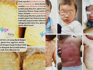 Kasus Bakery Gluten Free Palsu Berlanjut, Pelapor Malah Jadi Terlapor