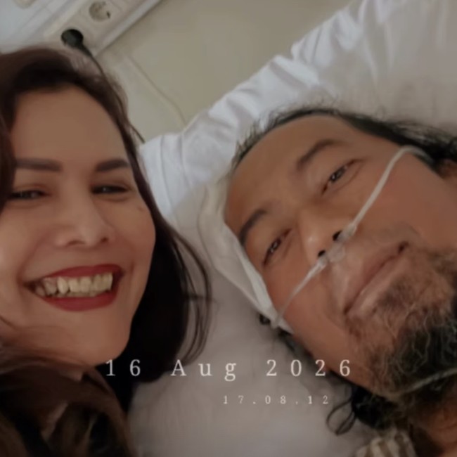 Sandy PAS Band Perlihatkan Kondisi Terkini Yukie Usai Kecelakaan