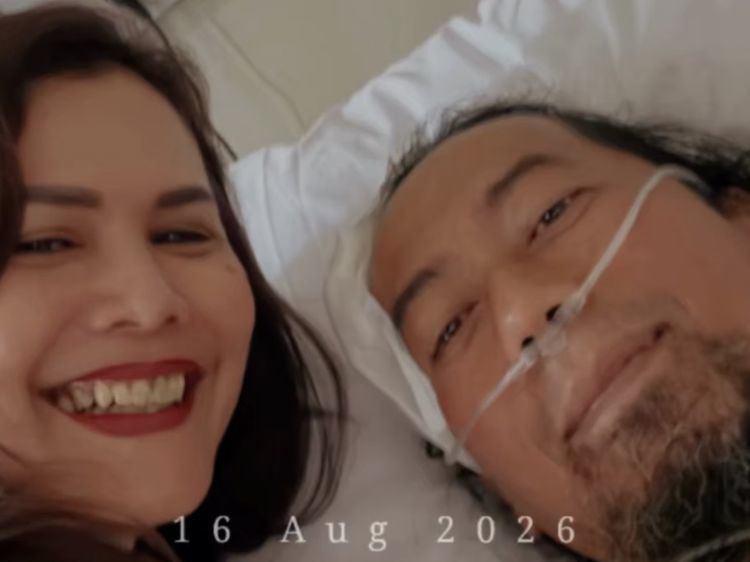 Sandy PAS Band Perlihatkan Kondisi Terkini Yukie Usai Kecelakaan