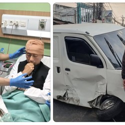 Mobil Ringsek, Yukie PAS Band Dapat 10 Jahitan di Kepala Usai Kecelakaan