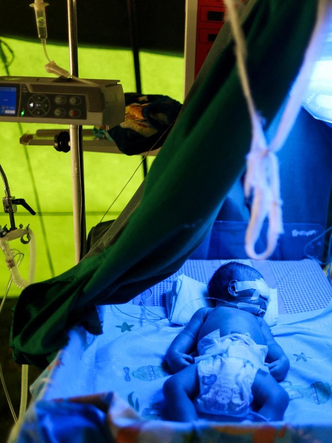 Potret Perawatan Bayi Baru Lahir di Tenda Darurat Pascagempa Flores
