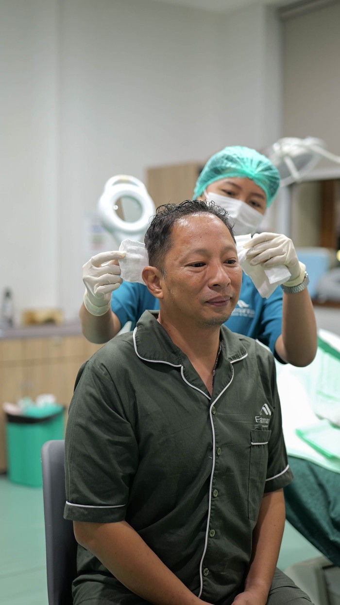 Aktor Ringgo Agus Rahman kembali melakukan transplantasi rambut tahap kedua untuk meningkatkan penampilannya.