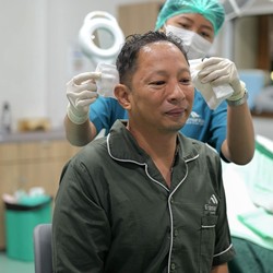 Ringgo Agus Rahman Lanjut Transplantasi Rambut Tahap Kedua, Pilih Produk Lokal