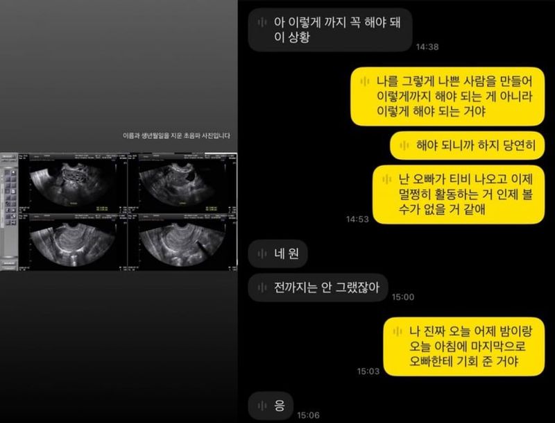 Hong Min Gi Dituduh Paksa Aborsi