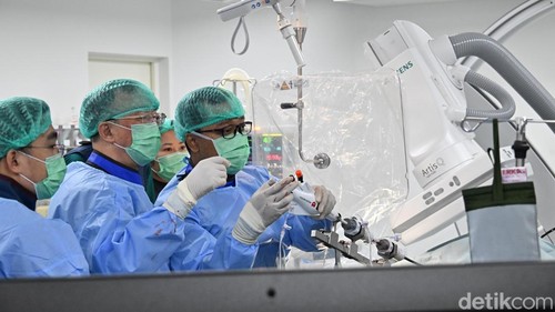 Para dokter spesialis melakukan prosedur M-TEER di Bali International Hospital, Denpasar.