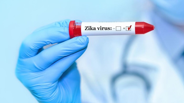 Doctor holding a test blood sample tube positive with Zika virus test