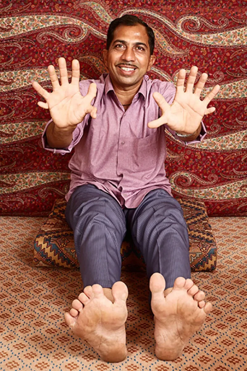 Bukan editan! Deretan foto ini memperlihatkan keunikan tubuh manusia yang benar-benar nyata, langka, dan dijamin bikin melongo.
