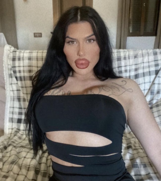 Keputusan itu diambil setelah Sofia sempat melarutkan filler di bibirnya untuk pertama kalinya dalam satu dekade. Namun, ia mengaku kembali terobsesi mendapatkan tampilan ekstrem. Foto: dok. Instagram Sofia Lips
