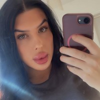 “Aku sangat puas dengan hasilnya sampai merasa siap melakukannya pada orang lain. Awalnya bibirku sangat meregang sampai aku kesulitan makan dan minum. Beberapa hari kemudian hanya terasa sedikit nyeri,” katanya. Foto: dok. Instagram Sofia Lips