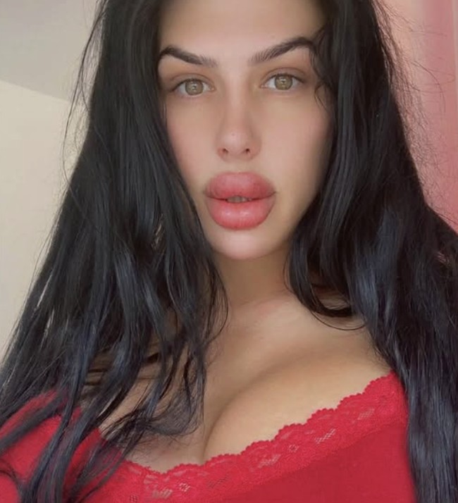 “Aku ingin kembali mendapatkan tampilan palsu yang maksimal. Tapi semua klinik menolak mentah-mentah. Mereka bilang bibirku sudah terlalu meregang dan tambahan filler bisa berbahaya,” ujar Sofia. Foto: dok. Instagram Sofia Lips