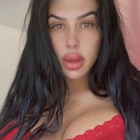 Aksi Nekat Wanita yang Dijuluki Bibir Terbesar, Suntik Filler Sendiri di Rumah