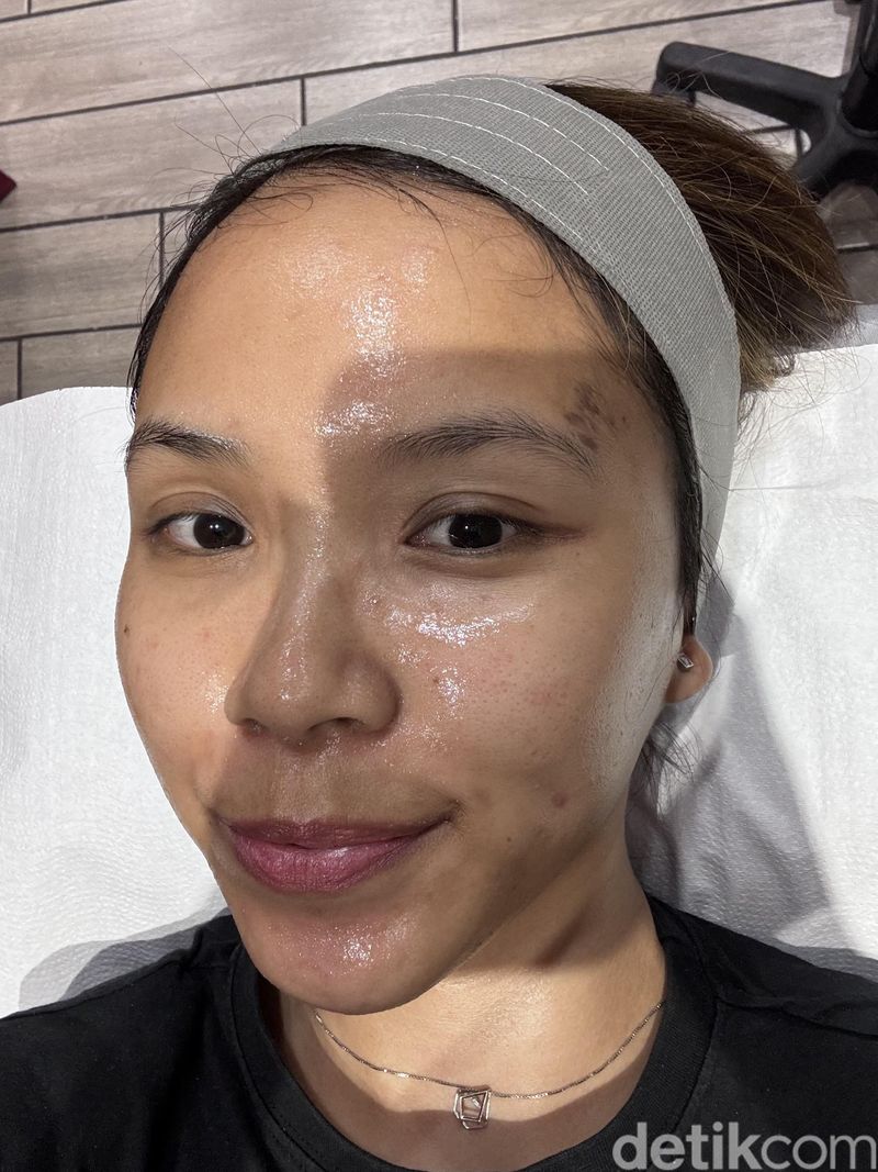 Review Lhala Peel