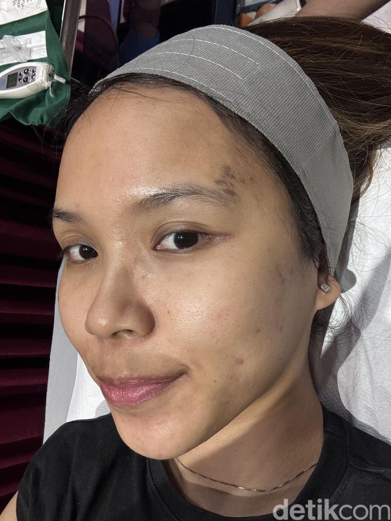 Review Lhala Peel