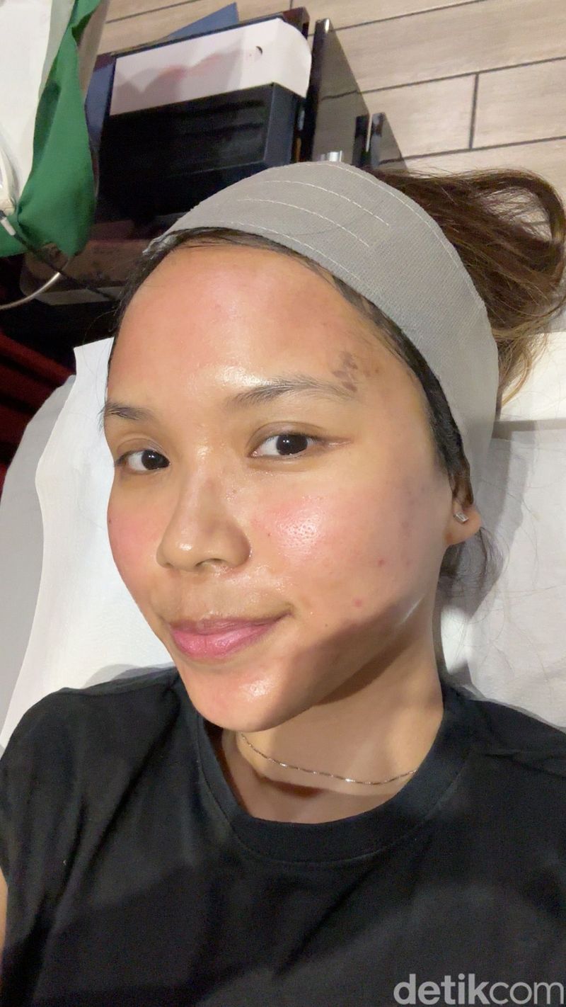 Review Lhala Peel