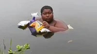Remaja Ini Berendam di Kolam Selama 5 Tahun karena Kulit Terasa Terbakar