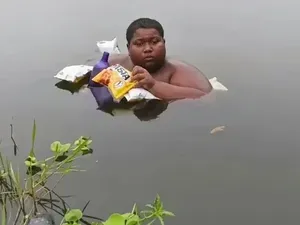 Remaja Ini Berendam di Kolam Selama 5 Tahun karena Kulit Terasa Terbakar